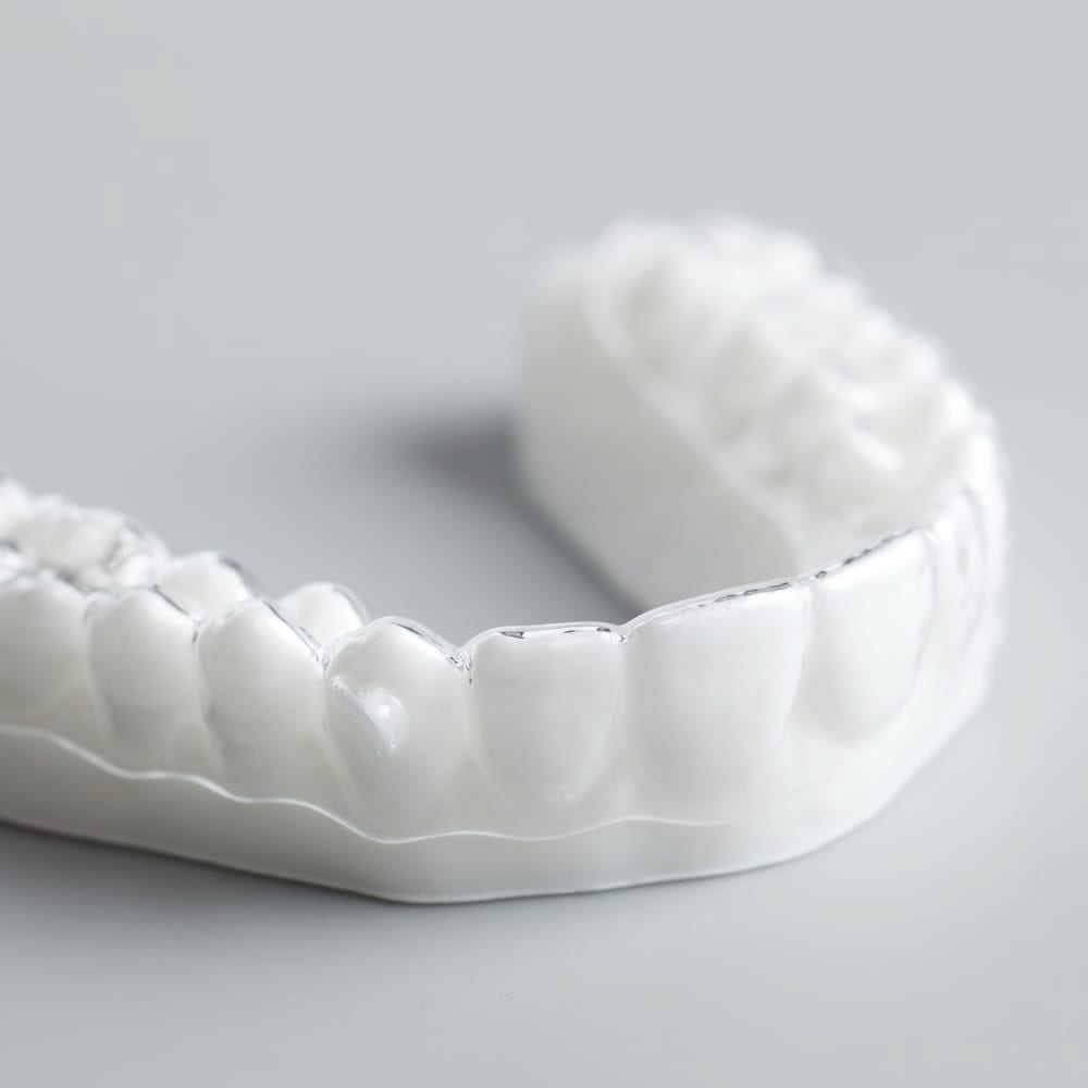 Aligner polymer — a material study.