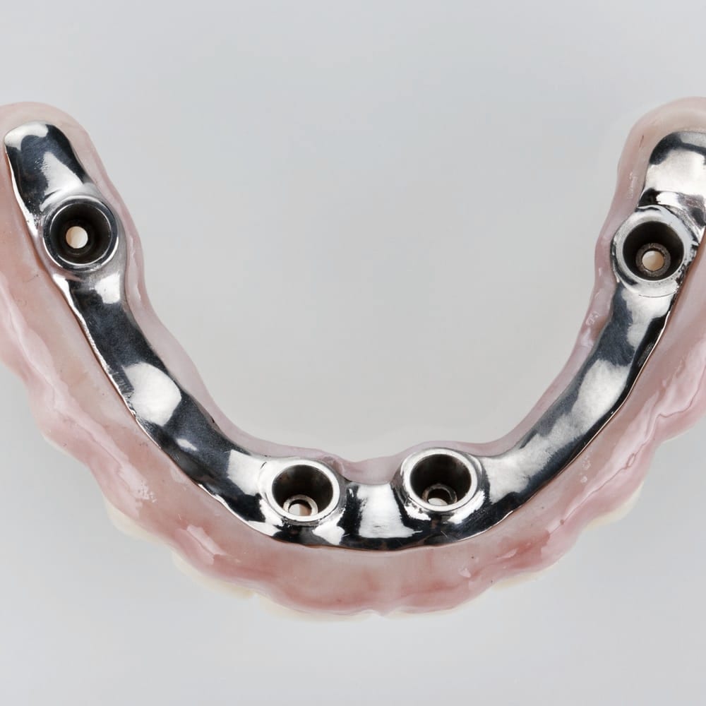 Zirconia framework — a material study.